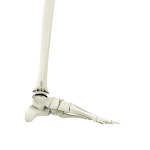 Ankle Joint Replacement