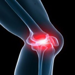 Knee Pain