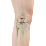 Patella Fracture